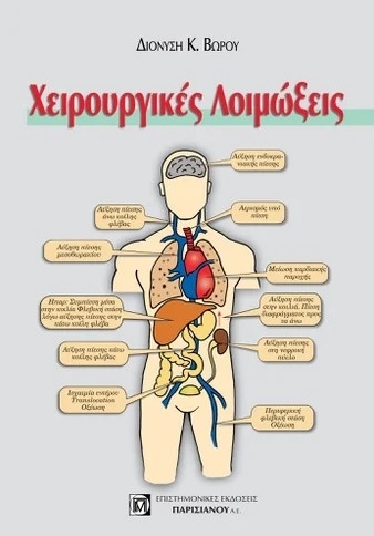 Χειρουργικές λοιμώξεις
